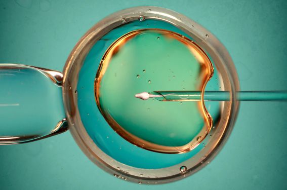 PMA pour toutes et conservation d’ovocytes hors raisons médicales : les décrets publiés PMA pour toutes et conservation d’ovocytes hors raisons médicales : les décrets publiés