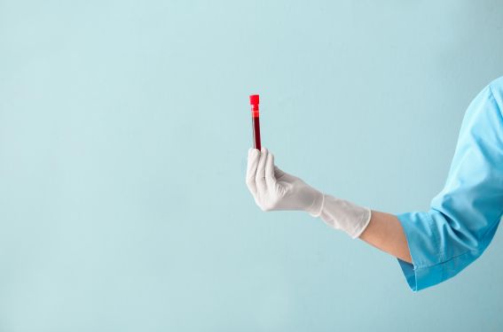 Hémorragies du post-partum, vérifier les plaquettes !